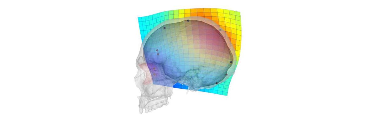 Siete días … 19 a 25 de mayo (evolución cráneo)